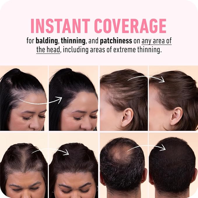 BOLDIFY Hairline Powder (LARGE, 10g) - Root Touch Up Hair Color for Gray Coverage - Bald Spot Concealing Hair Powder for Women & Men - 24-Hour Stain-Proof - Medium Brown