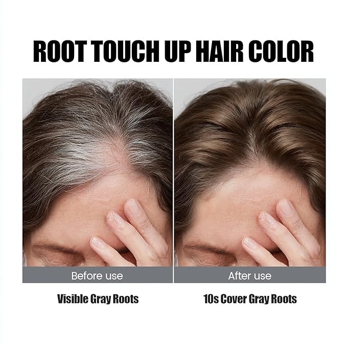 VOLLUCK Hair Thickening Fibers Spray, Temporary Colored Hair Thickener for Root Touch Up Spray, Grey Coverage Root Concealer for Women & Men, | Volumizing & Thickening | Medium Brown
