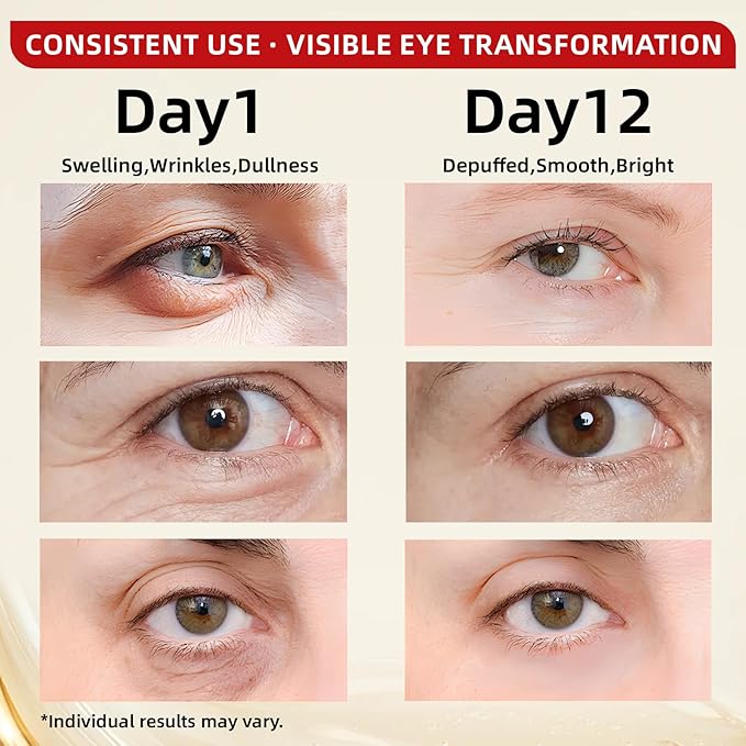 Caffeine & Retinol Under Eye Serum – Dermatologist-Tested, Fast Absorbing, Correction for Puffy Eye Bags Fine Lines Dark Circles Wrinkles While Providing Moisturizing Care 0.7 Oz