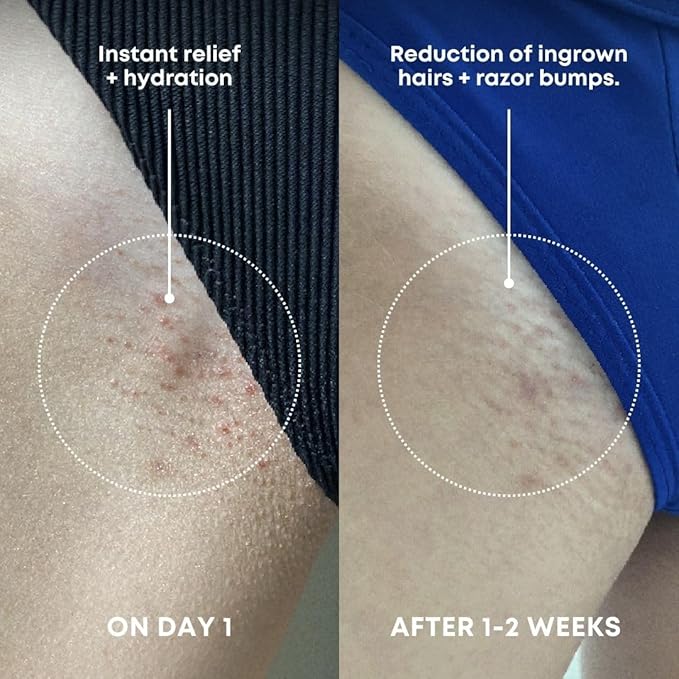Bushbalm Ingrown Hair Exfoliating Scrub – Pre-Shave Sugar Scrub for Ingrown Hairs, Razor Bumps & Dry Skin – Gently Buffs & Soothes Sensitive Skin – Nude, 236ml