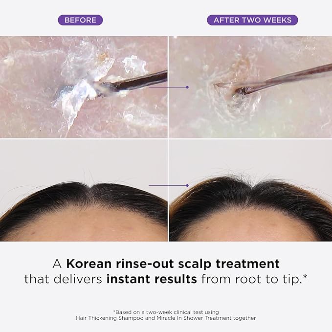 Dr. Groot Miracle in Shower Moisturizing Treatment for Hair Loss, Korean Hair Care Rinse, Rosemary Oil for Smooth, Healthier-Looking Hair in 5 Seconds, Scalp Revitalizing Solution, 250 ML