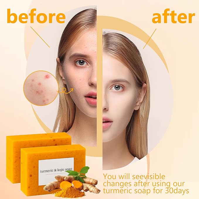 Lemon Turmeric Soap, Turmeric Soap Bar with Lemon for Face and Body (2)