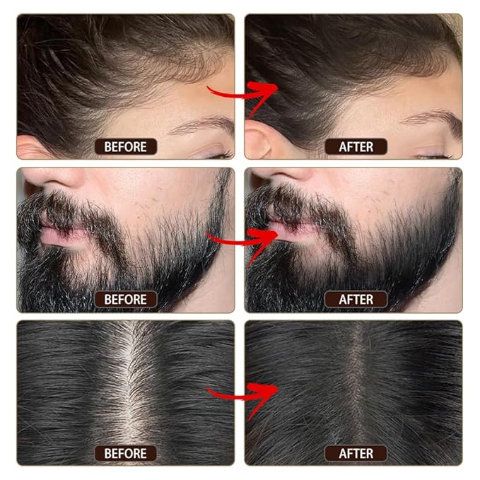 VOLLUCK Root Touch up Powder, Instant Hairline Powder for Thinning Areas and Gray Hair Coverage, Natural and Non-greasy Root Cover up for Women and Men (Light Brown, 0.35 Ounce)