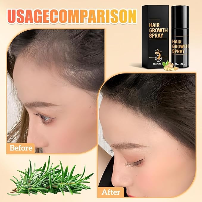 2PCS Hair Growth Spray,Hair Growth,Promotes Thicker, Fuller Hair For Women & Men – All Hair Types With Natural Ingredients
