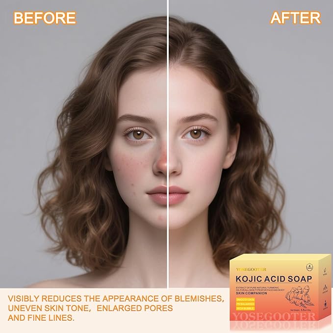Kojic Acid Soap, Turmeric Soap Bar for Dark Spots remover for face and body with Collagen, Vitamin E, Retinol, Hyaluronic Acid, Shea Butter,Original Japanese Complex, 2 Bars With Face Scrubber