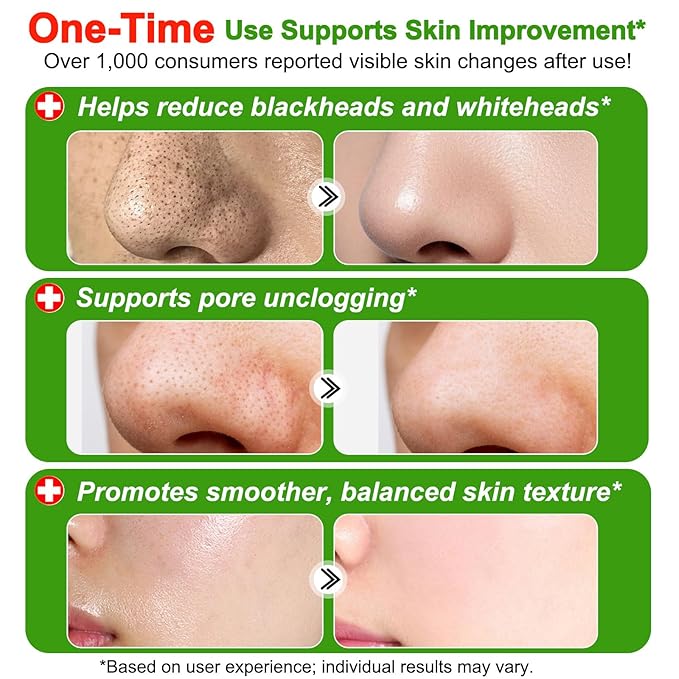 lofuanna Blackhead Remover, Nose Pore Strips Deep Cleansing Black Head Remover Strips Peel off Mask Nose Strips Skincare for All Skin