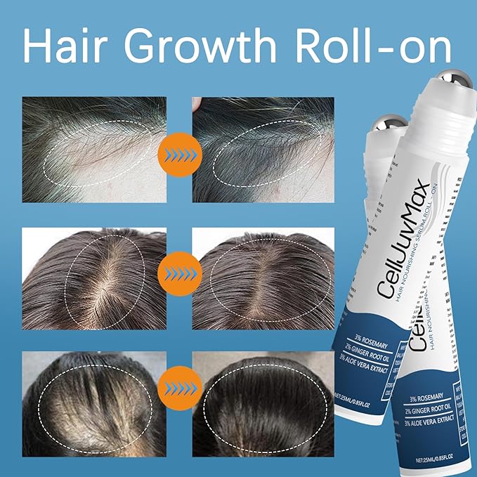 Hair Growth Serum Roll On – Rosemary & Peptide Formula for Thicker Hair, Fast-Absorbing & Non-Greasy, Advanced Follicle Support 0.85 Fl Oz (1 Pcs)