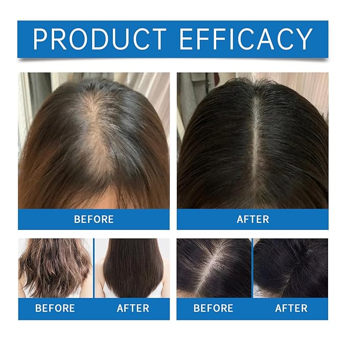 Rosemary Hair Growth Roll On Serum – Scalp Nourishment, Reduce Hair Loss & Follicle Strengthener for Thicker, Fuller Hair, All Hair Types, 1 fl oz