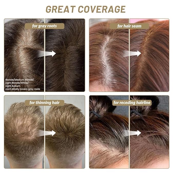 VOLLUCK Root Touch up Powder, Instant Hairline Powder for Thinning Areas and Gray Hair Coverage, Natural and Non-greasy Root Cover up for Women and Men (White, 0.35 Ounce)