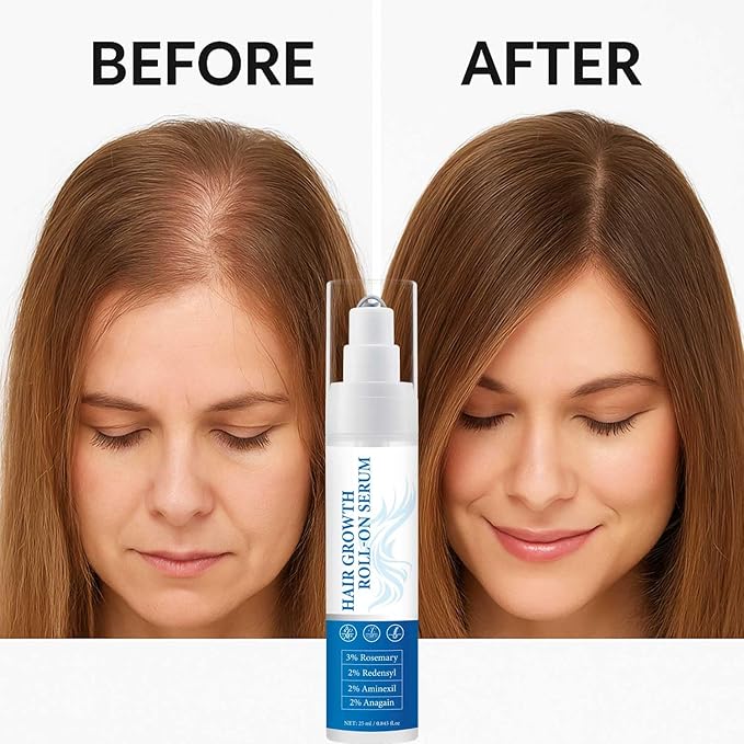 Rosemary Hair Growth Roll-On Serum 3% Rosemary Oil,2% Redensyl Anagain Strengthens Roots,Reduces Hair Loss,Volumizes & Nourishes Hair Lightweight,Non-Greasy Formula for Scalp Health 25mL*2Pcs