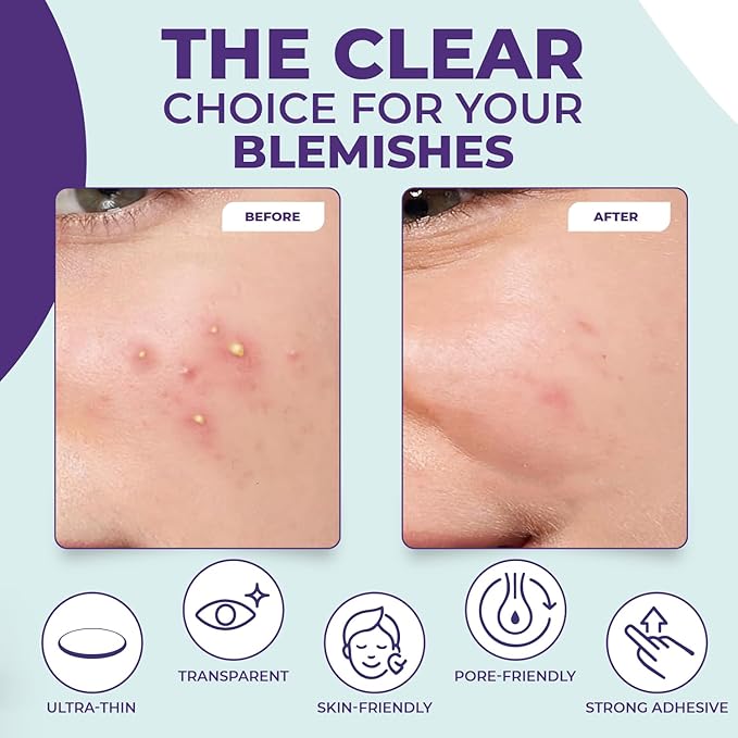 Pimple Patches for face and body | 36 Count (12mm), Invisible Hydrocolloid Acne patches – Face Stickers for Zits, dark spot , Blemishes, Pore strips, Forehead pimple patch , Invisible spot cover