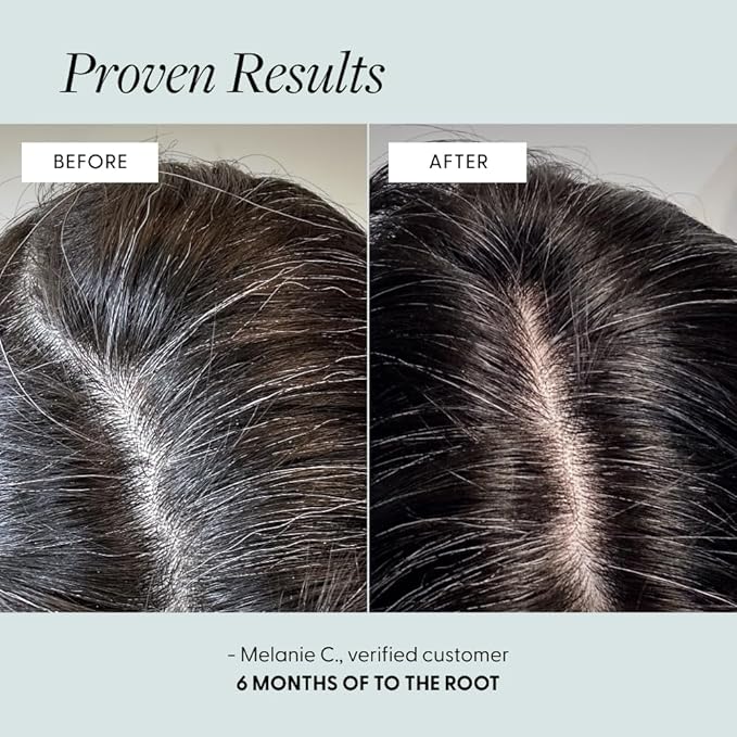 Arey To The Root Hair Serum for Women & Men | Slows Grey Hair Growth & Preserves Pigment in 3-6 Months | Promotes Healthier Hair & Adds Volume | Vegan, Oil-Free, Scent-Free Formula (1 Month)