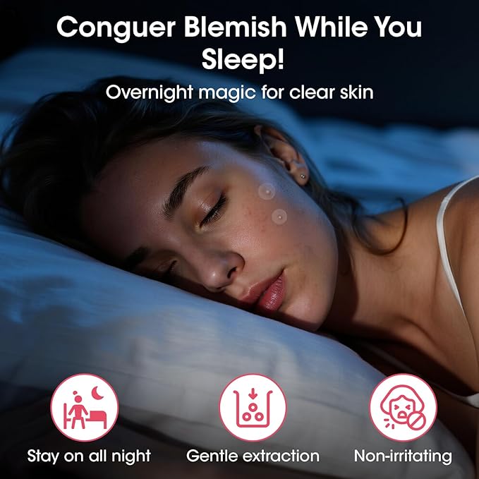 Pimple Patches for Face, 320 Counts 5 Sizes Large Patches, Hydrocolloid Blemishes Patch, Spot Dots Cover for Body, Chin, Cheek Zits & Blemish & Breakouts