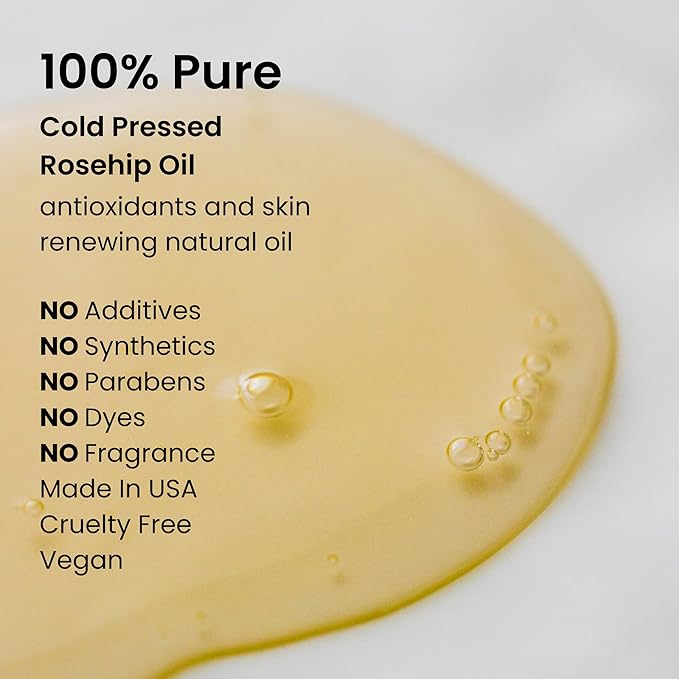 natural outcome Rosehip Oil 100% Pure Cold-Pressed Rosehip Seed Face Oil - Anti-Aging Facial Oil to Plump, Balance & Hydrate 1 oz