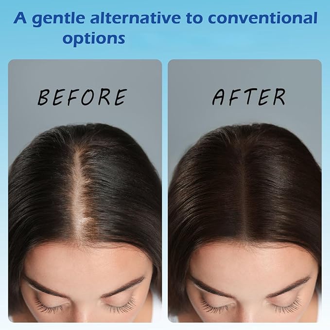 Hair Growth Roll-On Serum - 3% Rosemary, 3% Redensyl, 2% AnaGain + Biotin & Niacinamide, Portable Roller for Targeted Scalp Nourishment, No-Rinse Formula & Fast Absorbing, Easy to Apply Anywhere