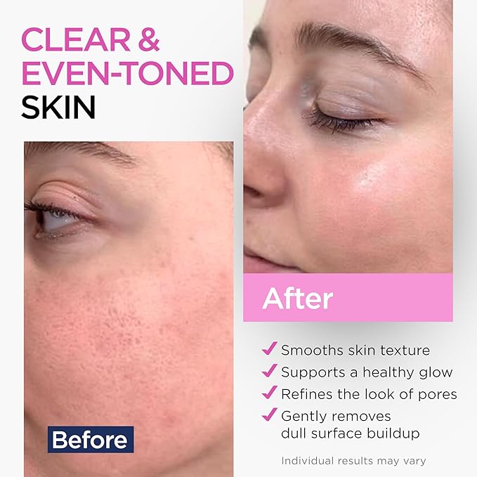 Glycolic Acid Serum for Face 15% (1 Oz) - Advanced Formula to Support Skin Radiance, Addressing Uneven Tone & Fine Lines