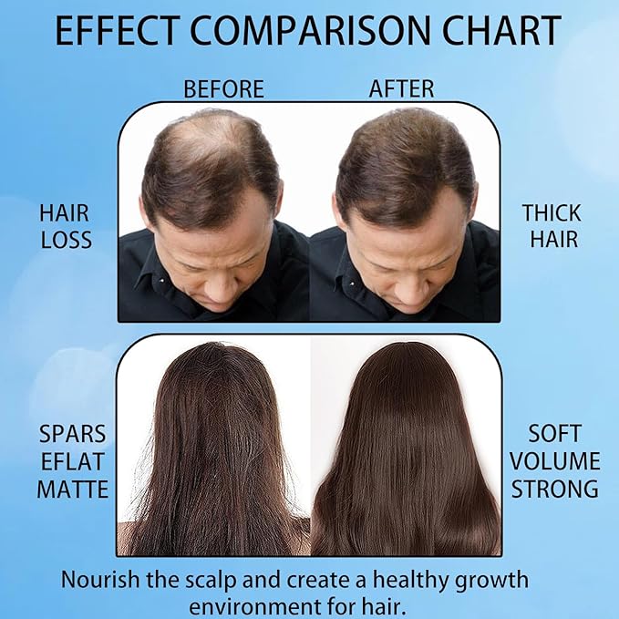 Hair Growth Roll On, Rosemary Hair Growth Serum Roll On, Advanced Hair Growth Roll-On Serum, Thicker & Stronger Hair, Nourishes Scalp & Roots for All Hair, Women and Men (2pcs)