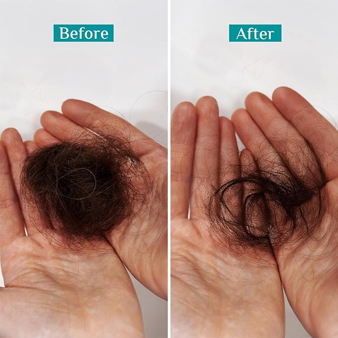 Pilgrim Redensyl & Anagain Hairfall Control Shampoo with Korean Black Rice 6.76 Fl Oz (200ml) | Anti Hairfall shampoo for Men & Women | Reduces Hairfall | Enhance Hair Thickness | For All Hair Types