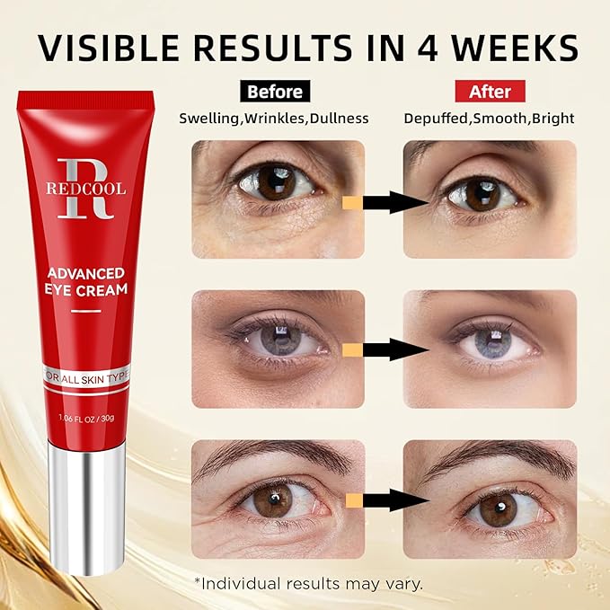 Retinol Eye Cream for Dark Circles and Puffiness, Hydrating Under Eye Cream for Dark Circles, Anti Aging Dark Circle Eye Cream for Fine Lines, Wrinkles, Firming Eye Contour, 1.06 oz