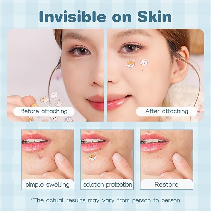VENROCK Pimple Patches for face,24 Cute Pet Shapes 48 Count Hydrocolloid Acne Treatment for Covering Zits & Blemishes Spot for Kids & Adults, with Salicylic Acid, Tea Tree Oil, Centella Asiatica Oil