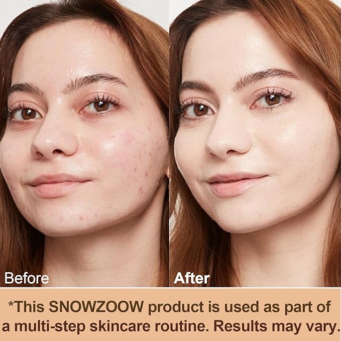 Medium/Light Spectrum-Color Changing Foundation 4 in 1 -with SPF 50+,Hydrating Longwearing & Waterproof，Makeup Care (light spectrum -Gold Lid- suitable for people with fair skin, 1.2oz)