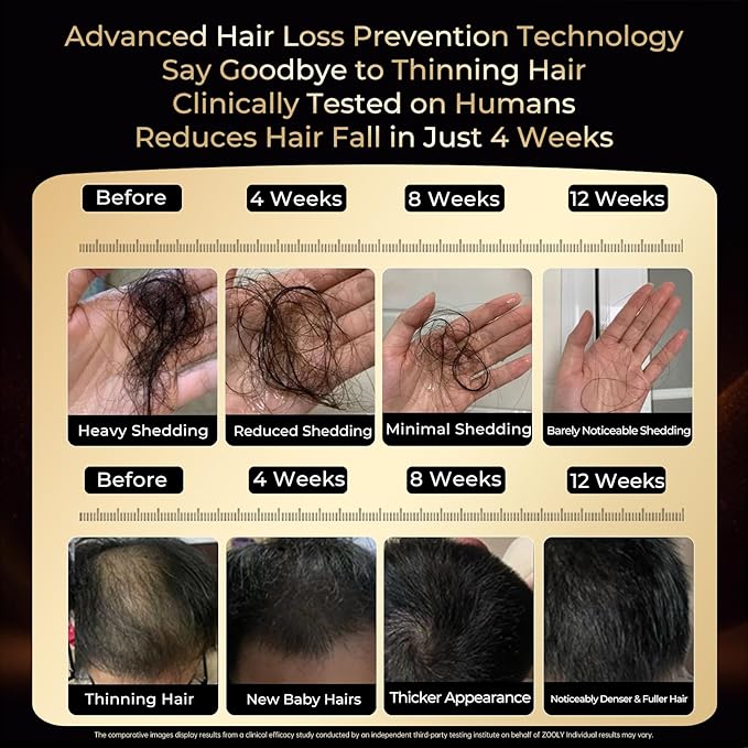 Scalp Serum for Hair Growth, Roll-On Essence Anti-Hair Loss Treatment for Women & Men, Silicone Free, 0.5 Fl Oz