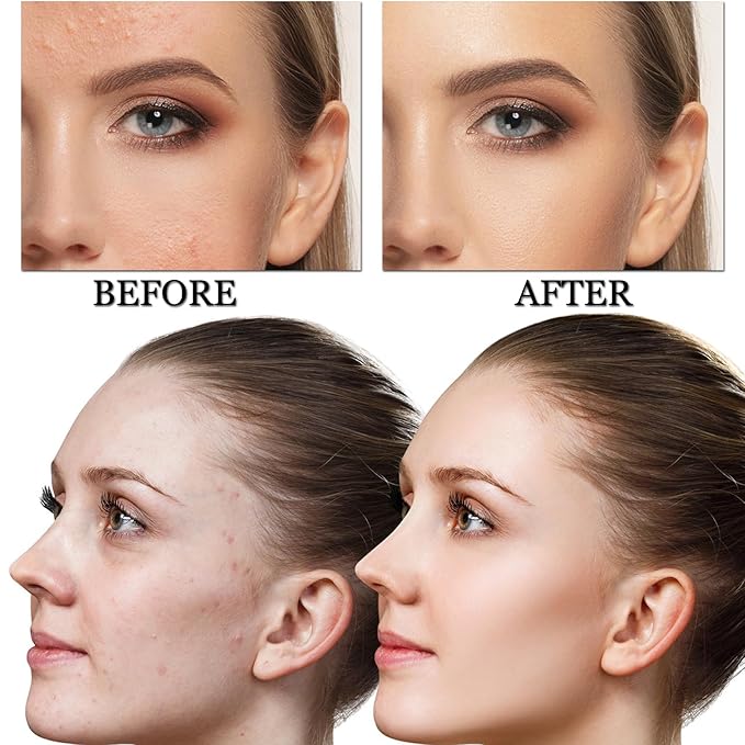 CAHIUYOA Mushroom Head Air Cushion CC Cream BB Cream Mushroom Head Foundation Full Coverage Foundation Makeup Long Lasting Moisturize Matte Concealer - 06 Medium Deep