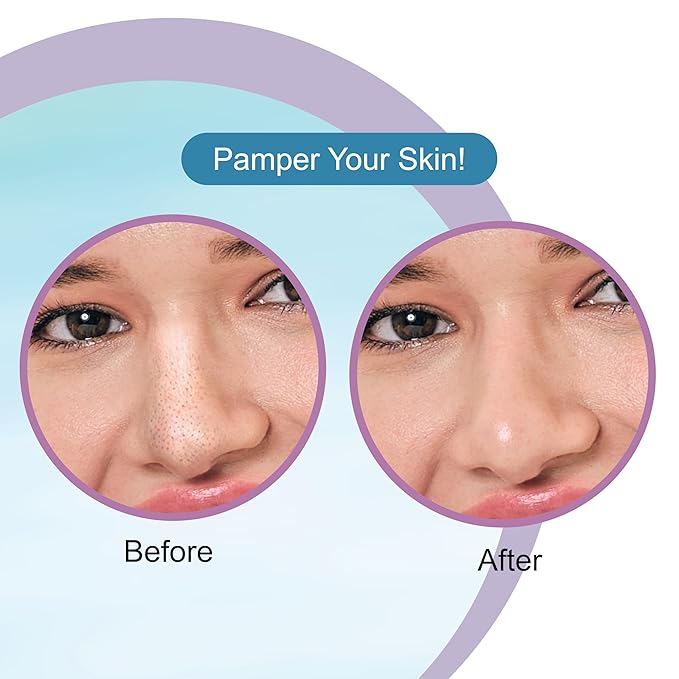 DR.RASHEL Hyaluronic Nose Pore Strips For Pore Cleansing, Instant And Painless Blackheads Removal | Deep Purifying Blackhead Remover Strips for Nose | 20 PCS (10 Strips & 10 Wipes)