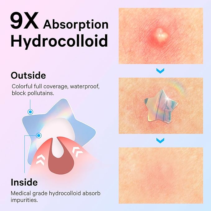 Sosky Hologram Pimple Patches for Face, Hydrocolloid Acne Patches with Salicylic Acid, Cute Star Zit Stickers,Colorful Blemish Covers,48 Count Blue Pink Star Heart Moon Flower