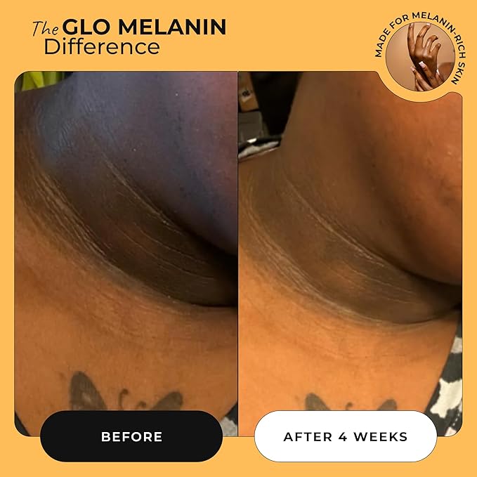 Glo Melanin Magic Eraser Dark Spot Cream for Face, Body & Sensitive Areas - inner thighs remover Made in USA - Faded Cream for Black Spots 1.7 Oz
