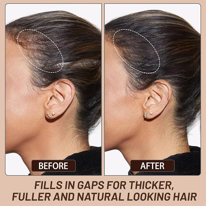 VOLLUCK Root Touch up Powder, Instant Hairline Powder for Thinning Areas and Gray Hair Coverage, Natural and Non-greasy Root Cover up for Women and Men (Medium Blonde, 0.35 Ounce)
