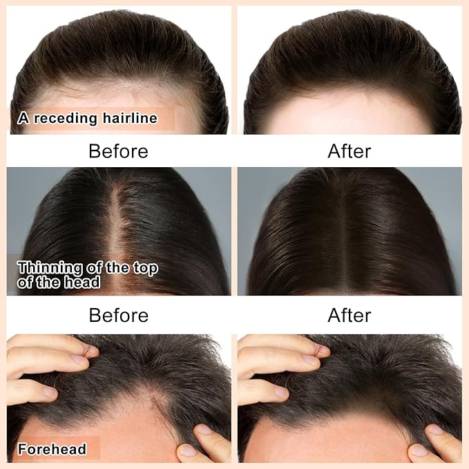 Boobeen Hairline Concealer Stick - Hair Shadow Powder, Waterproof Root Touch-Up to Cover Grey Hair and Conceal Hair Loss & Thinning