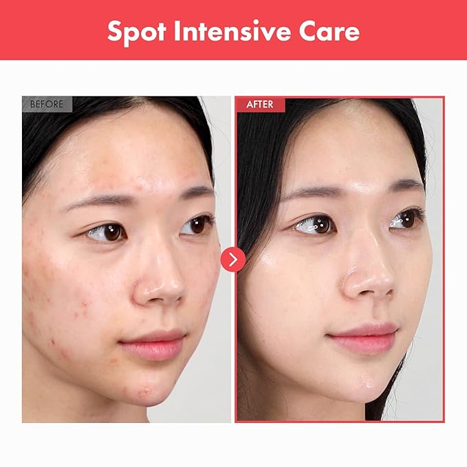 TOSOWOONG Ovalicin Skin Clear Cream, Skin Soothing, Moisturizing with Niacinamide and Sulfur, Korean Skincare, 50g, 1.76 oz.