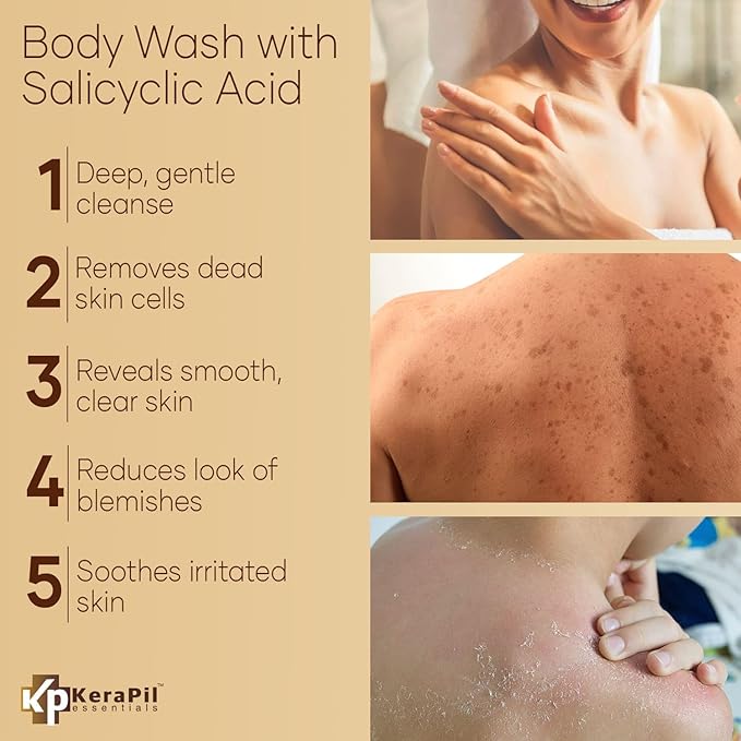 Exfoliating Body Wash with Salicylic Acid - No Dry Out, Gentle Exfoliates Rough and Bumpy Skin, Body Acne Wash, BHA & AHA - Coconut and Vanilla Salicylic Acid Body Wash - (16 fl oz x 2)