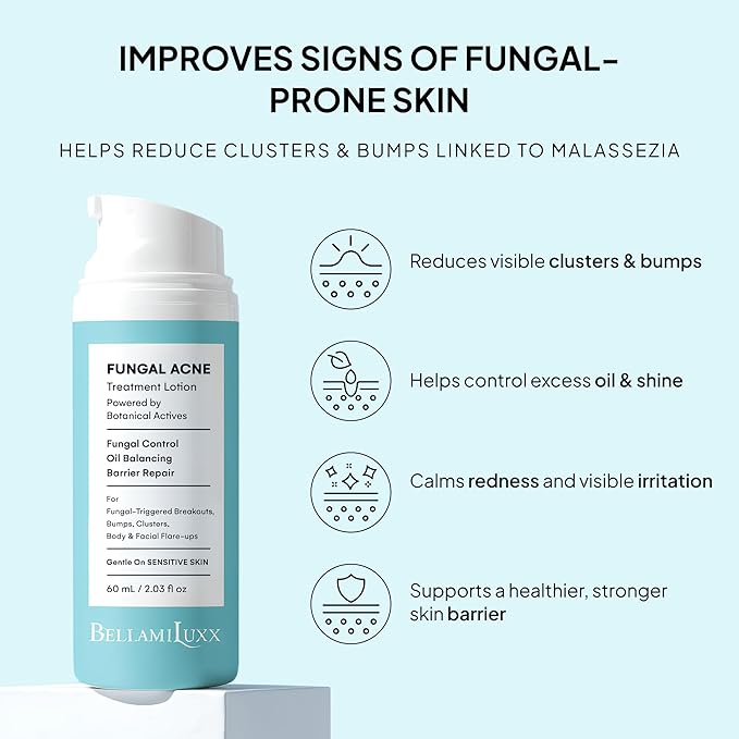 Fungal Acne Treatment Lotion: Effective Face & Body Pimple Cream for Bumps, Clusters, Itch & Redness – Fungal Prone Skin Acne Treatment Moisturizer for Teens & Adults with Natural Actives