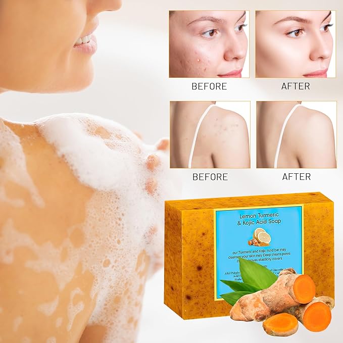 Lemon Turmeric Kojic Soap - Turmeric Soap Bar for Face and Body, Natural Handmade Soaps Bar for All Skin Types, Daily Use Skin Care Deep Cleansing Moisturizing (2pcs)