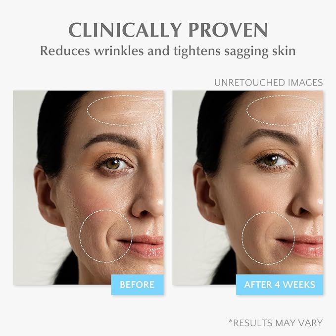 EnaSkin Retinol Face Wrinkle Cream: Collagen Anti Aging Moisturizer - Neck/Forehead Tightening - 7% Hyaluronic Acid Serum, Women-Men's Mature/Dry Skin, 1.7 Oz