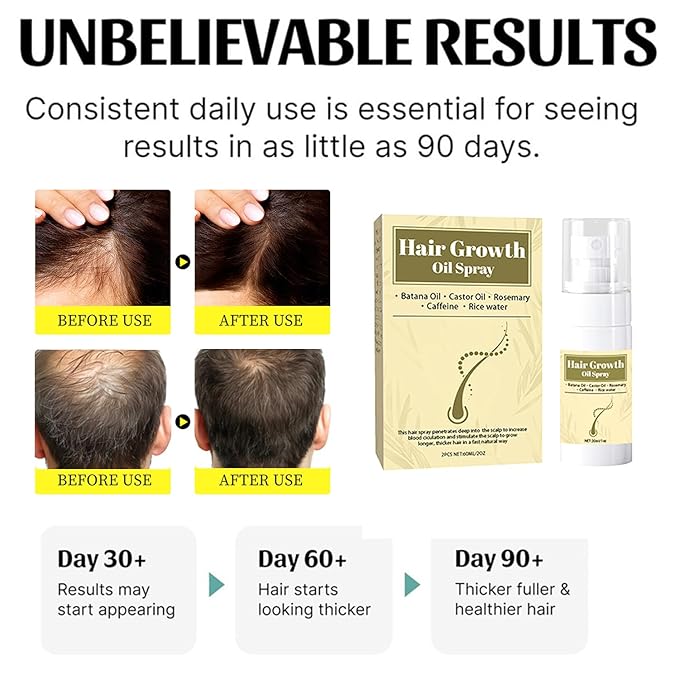 Hair Growth Oil Spray, 2 Pcs Natural Rosemary Batana Castor Oil, Dr. Sebi Approved, Vegan Hair Growth Thickening for Women Men Thinning Hair Regrowth (Beige)