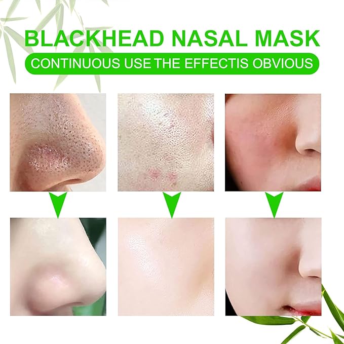 Pore Strips,Natural Charcoal Deep Cleansing Pore Strips ，Nose Strips for Blackheads，Black Heads Removal for Nose Face，Deep Cleansing for All Skin Types(80pcs)