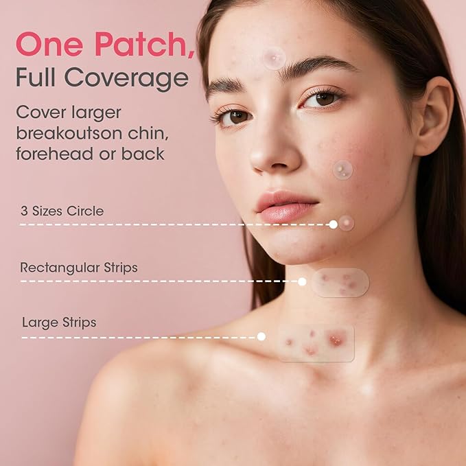Pimple Patches for Face, 320 Counts 5 Sizes Large Patches, Hydrocolloid Blemishes Patch, Spot Dots Cover for Body, Chin, Cheek Zits & Blemish & Breakouts