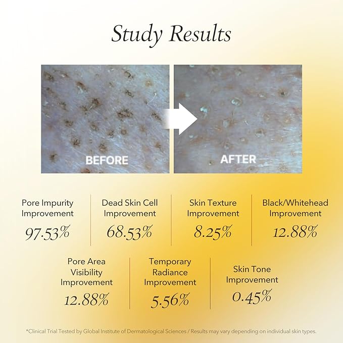 APRILSKIN Calendula Peel Off Pore Minimizing Facial Mask with Jelly Brush