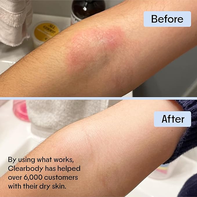 Clearbody Organics Manuka Honey Cream for Ezcema & Dry Skin - Manuka Honey Ointment - Colloidal Oatmeal, Aloe & Natural Ingredients - Fast Relief Lotion for Reactive Skin - No Greasy Residue - 1 oz