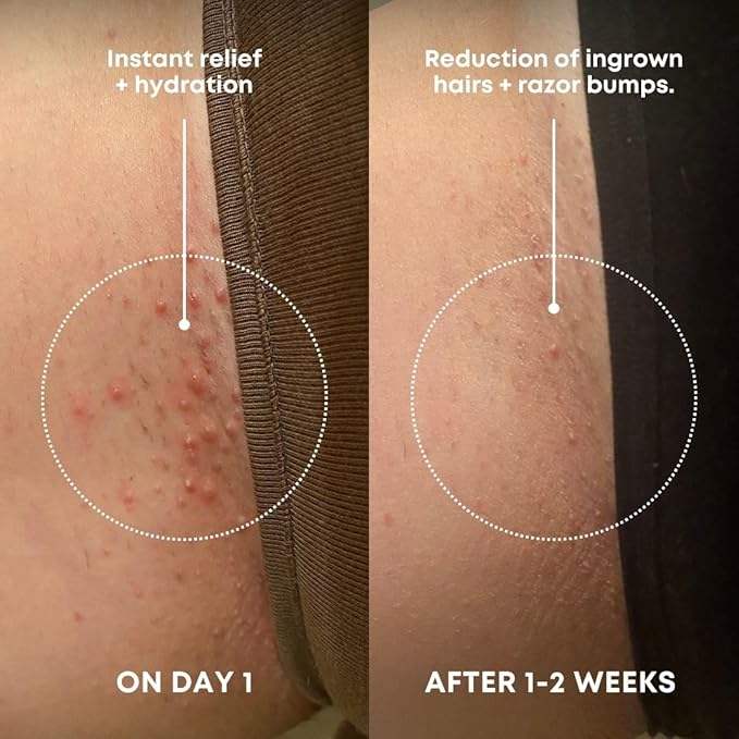 Bushbalm Ingrown Hair Exfoliating Scrub – Pre-Shave Sugar Scrub for Ingrown Hairs, Razor Bumps & Dry Skin – Gently Buffs & Soothes Sensitive Skin - Sweet Escape 236 ml