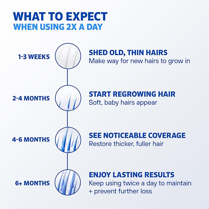Rogaine Men’s 5% Minoxidil Foam Hair Regrowth Treatment, FDA Approved Brand, Proven to Improve Hair Regrowth, Extra Strength Minoxidil Foam, Unscented Aerosol, 4 Month Supply (4 x 2.11 oz Cans)