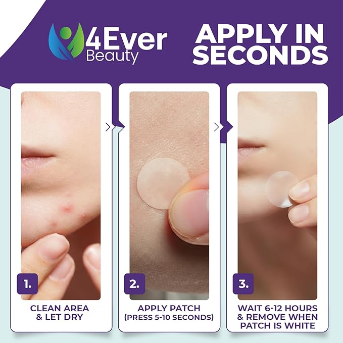 Pimple Patches for face and body | 36 Count (12mm), Invisible Hydrocolloid Acne patches – Face Stickers for Zits, dark spot , Blemishes, Pore strips, Forehead pimple patch , Invisible spot cover