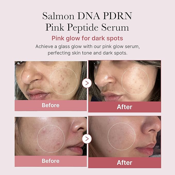 medicube Intensive Moisture & Skin Plumping Set: Salmon DNA PDRN Pink Peptide Serum and Salmon DNA PDRN Pink One Day Serum | Holiday Stocking Stuffers