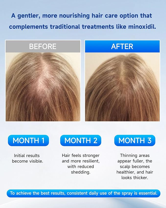 Hair Growth Serum Roll On with Rosemary, Redensyl, Biotin, AnaGain & Niacinamide,No-Rinse & Non-Greasy For All Hair Types (1.01 fl.oz 1Pack, 3% Rosemary)