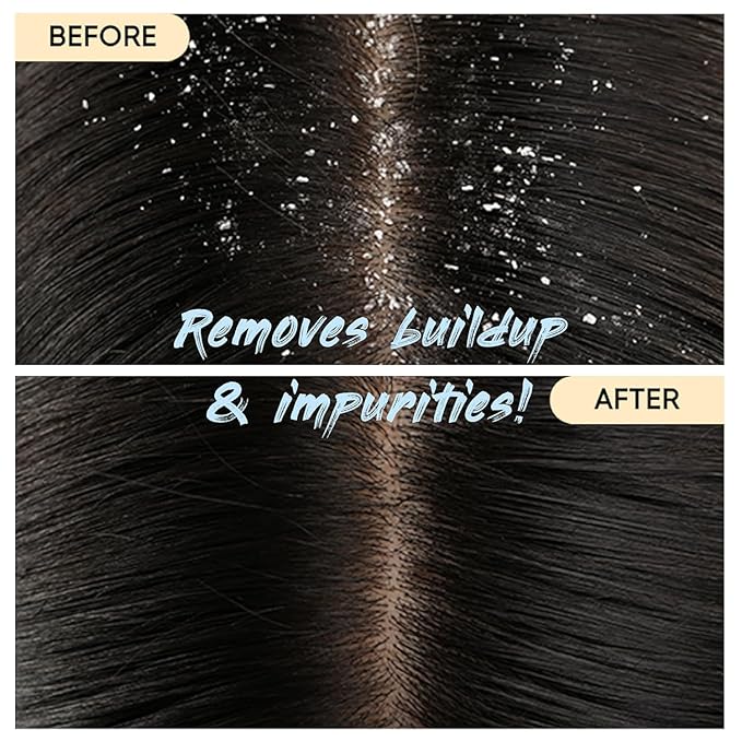 Charcoal Shampoo Bar 2.0 - Hydrating & Moisturizing Natural Hair Soap Bar Shampoo for Excess Oil Build-Up & Scalp Nourishment - Bathing Soap Solid Shampoo for All Hair Types (120g, 4.23oz)