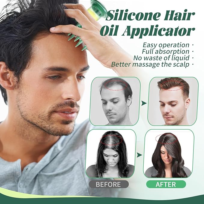 Scalp Massager Applicator Comb Silicone Hair Oil & Serum Brush for Even Distribution – No Mess, Easy-to-Use Scalp Treatment Tool for All Hair Types
