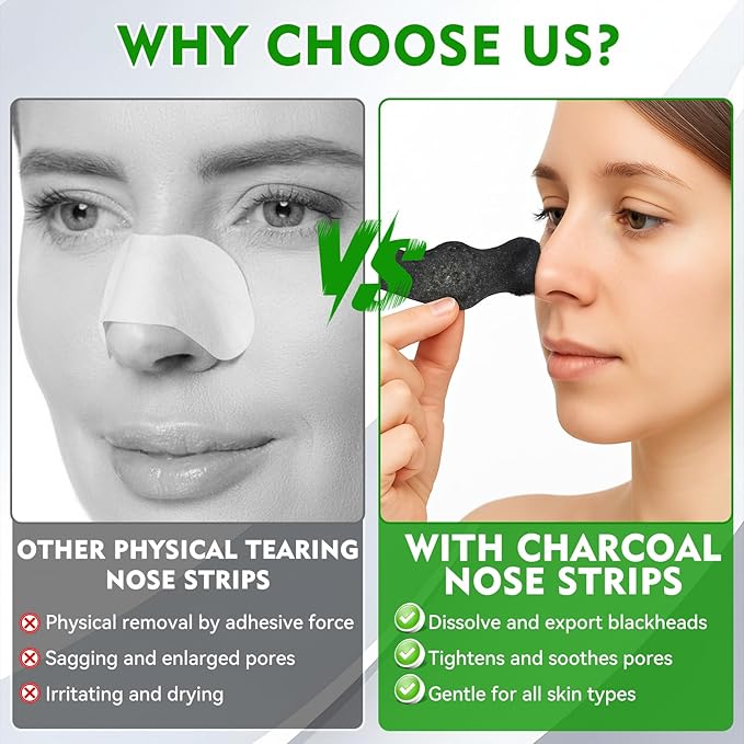 Blackhead Remover Strip, Nose Strips Blackhead Remover, Deep Cleansing & Oil Control, Ideal for All Skin Types (10 Pack)